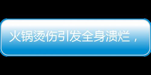 火鍋燙傷引發(fā)全身潰爛，三歲男童遭遇驚魂事件