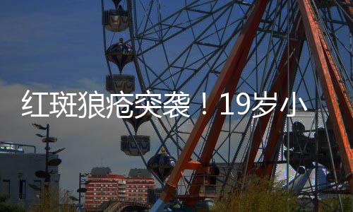 紅斑狼瘡?fù)灰u！19歲小伙臉上頻繁爆痘背后的真相
