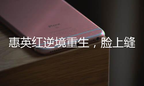 惠英紅逆境重生，臉上縫了89針的堅(jiān)韌故事