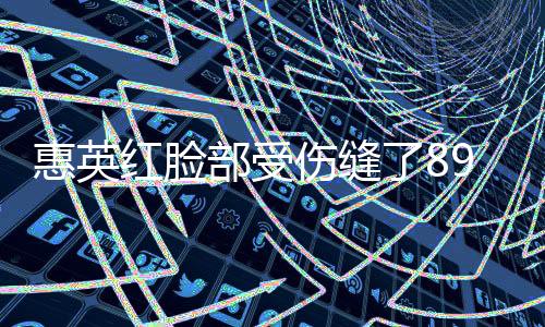 惠英紅臉部受傷縫了89針，經(jīng)歷令人震驚