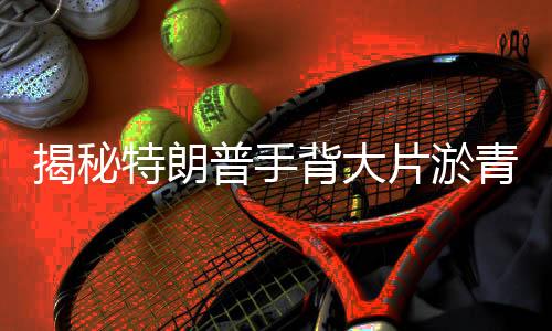 揭秘特朗普手背大片淤青，握手文化背后的故事與白宮回應
