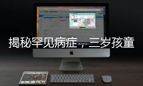 揭秘罕見(jiàn)病癥，三歲孩童全身離奇起皮脫衣事件引發(fā)關(guān)注