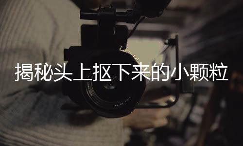 揭秘頭上摳下來(lái)的小顆粒，成因、影響與應(yīng)對(duì)之道