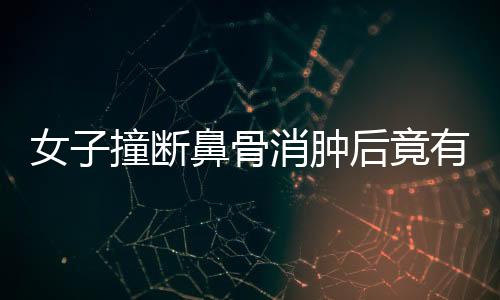 女子撞斷鼻骨消腫后竟有高鼻梁，奇妙經(jīng)歷揭示醫(yī)學(xué)魅力