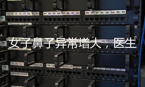 女子鼻子異常增大，醫(yī)生迅速察覺(jué)不尋?，F(xiàn)象