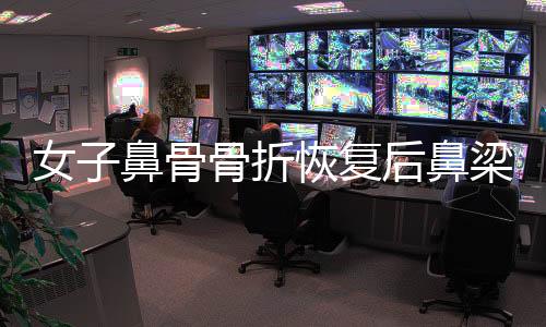 女子鼻骨骨折恢復(fù)后鼻梁挺拔，重拾自信之美