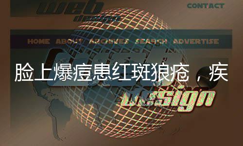 臉上爆痘患紅斑狼瘡，疾病解析與應(yīng)對之道