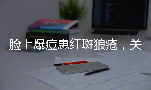 臉上爆痘患紅斑狼瘡，關(guān)注病癥與應(yīng)對之道