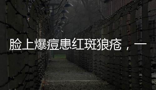 臉上爆痘患紅斑狼瘡，一位患者的深度解析與自我反思