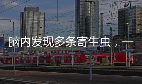 腦內(nèi)發(fā)現(xiàn)多條寄生蟲，一種健康警示